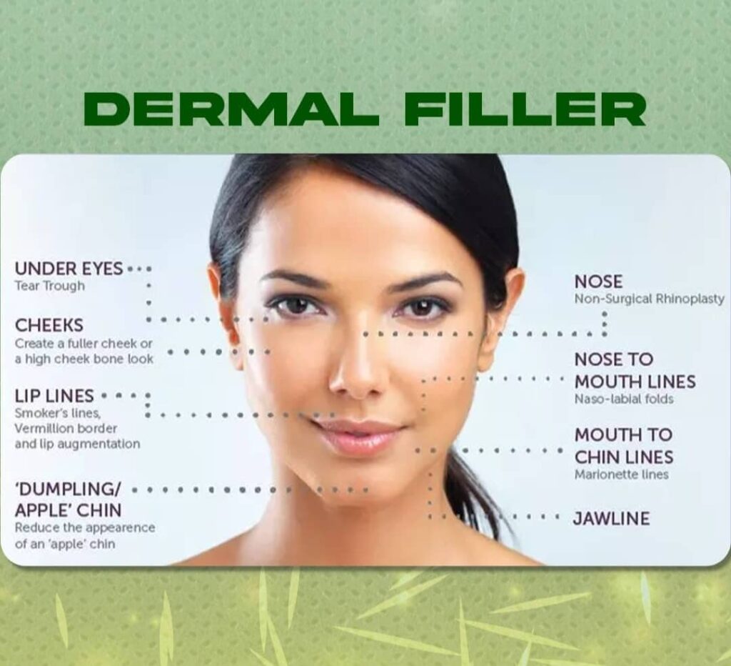 Derma Filler