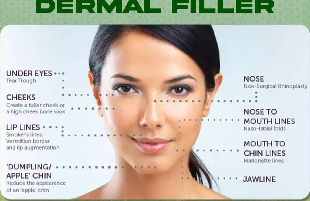 Derma Filler