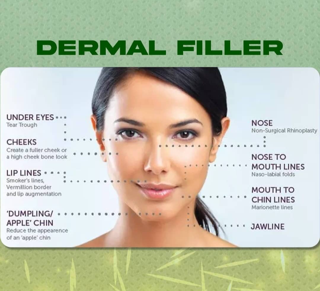 Derma Filler